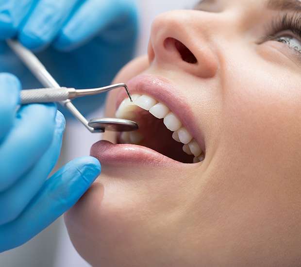 Mooresville Dental Bonding