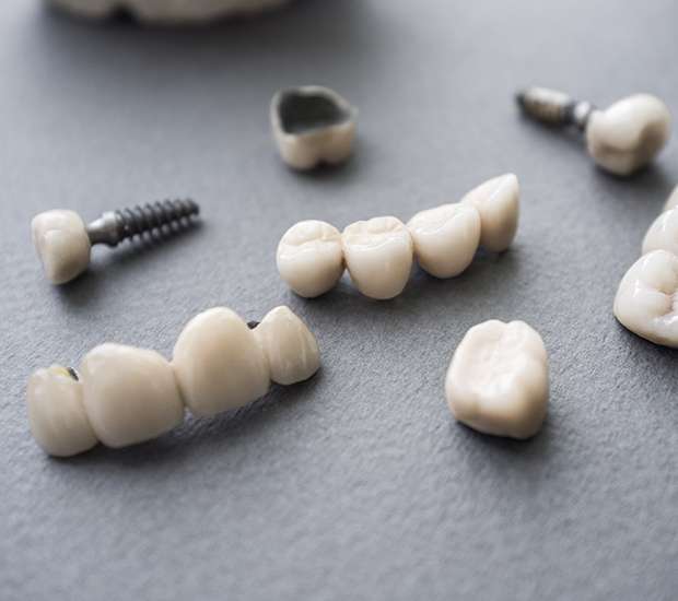 Mooresville The Difference Between Dental Implants and Mini Dental Implants